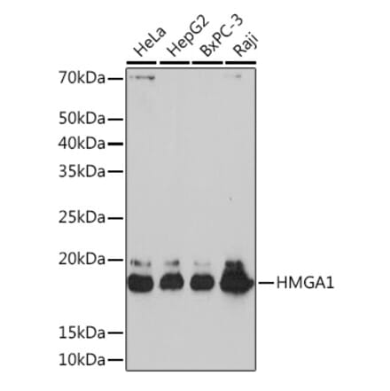 Western Blot - Anti-HMGA1 Antibody [ARC1060] (A307749) - Antibodies.com