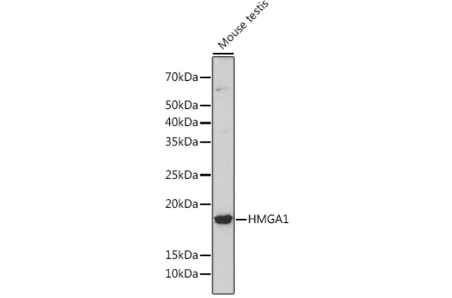Western Blot - Anti-HMGA1 Antibody [ARC1060] (A307749) - Antibodies.com