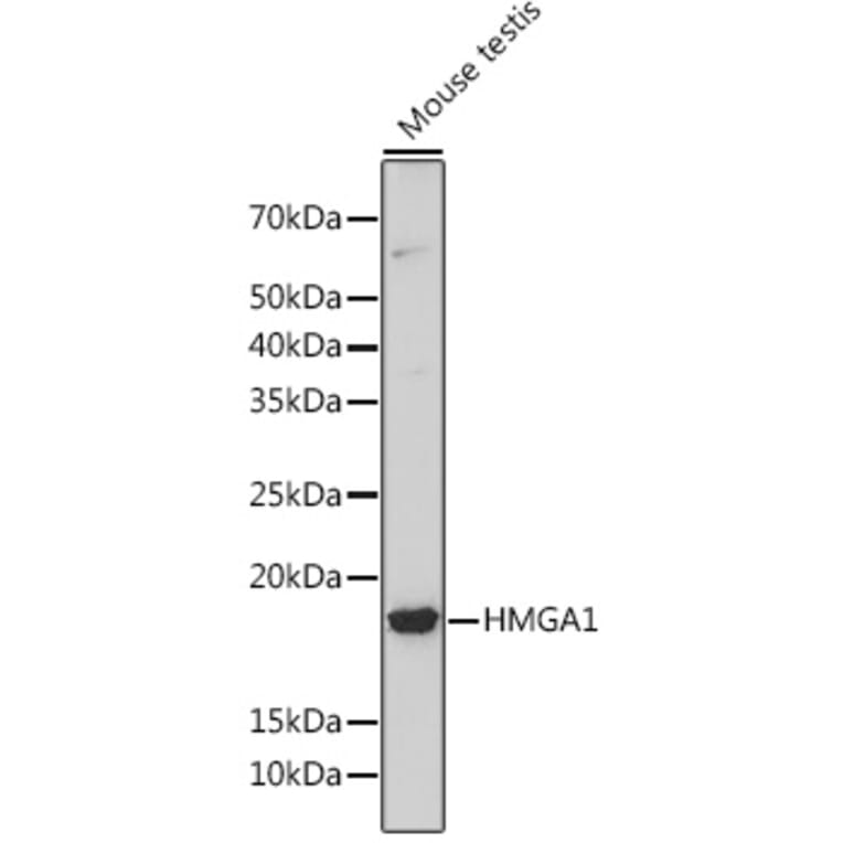 Western Blot - Anti-HMGA1 Antibody [ARC1060] (A307749) - Antibodies.com