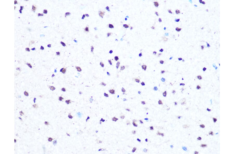 Immunohistochemistry - Anti-HMGA1 Antibody [ARC1060] (A307749) - Antibodies.com