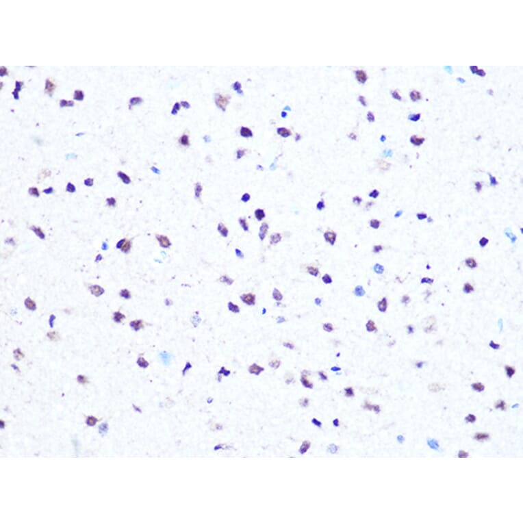 Immunohistochemistry - Anti-HMGA1 Antibody [ARC1060] (A307749) - Antibodies.com