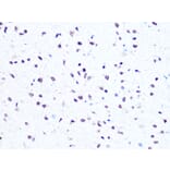 Immunohistochemistry - Anti-HMGA1 Antibody [ARC1060] (A307749) - Antibodies.com