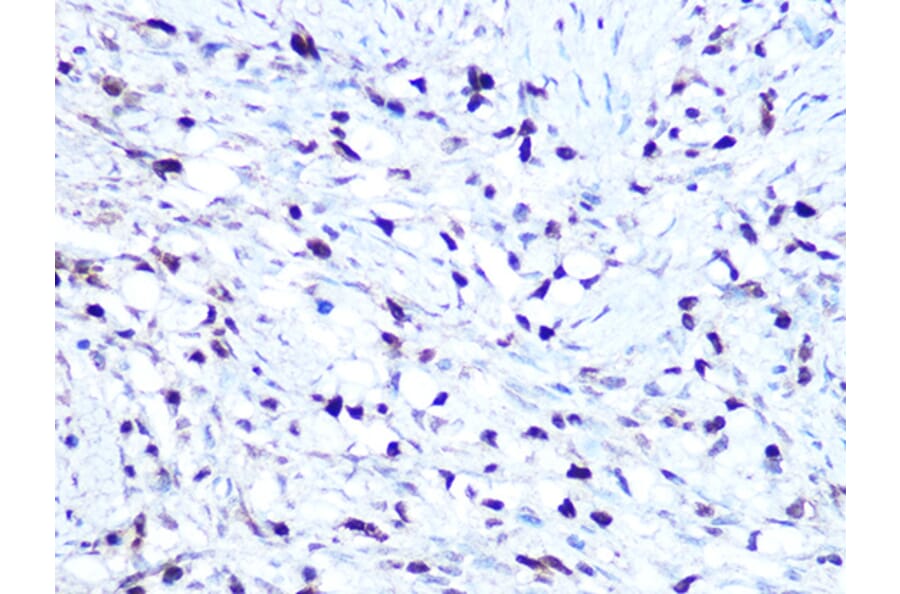 Immunohistochemistry - Anti-HMGA1 Antibody [ARC1060] (A307749) - Antibodies.com