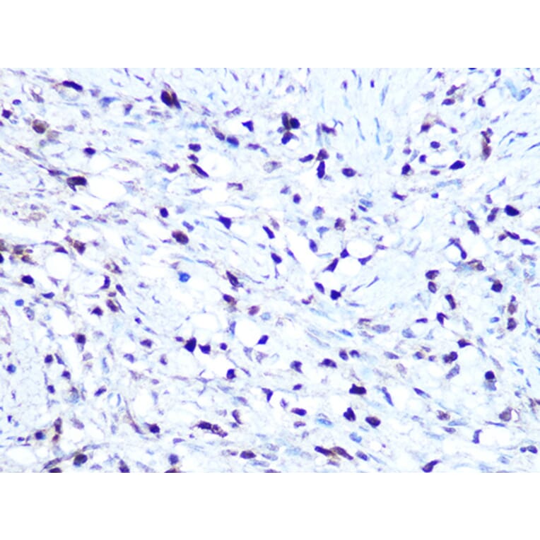 Immunohistochemistry - Anti-HMGA1 Antibody [ARC1060] (A307749) - Antibodies.com