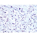 Immunohistochemistry - Anti-HMGA1 Antibody [ARC1060] (A307749) - Antibodies.com