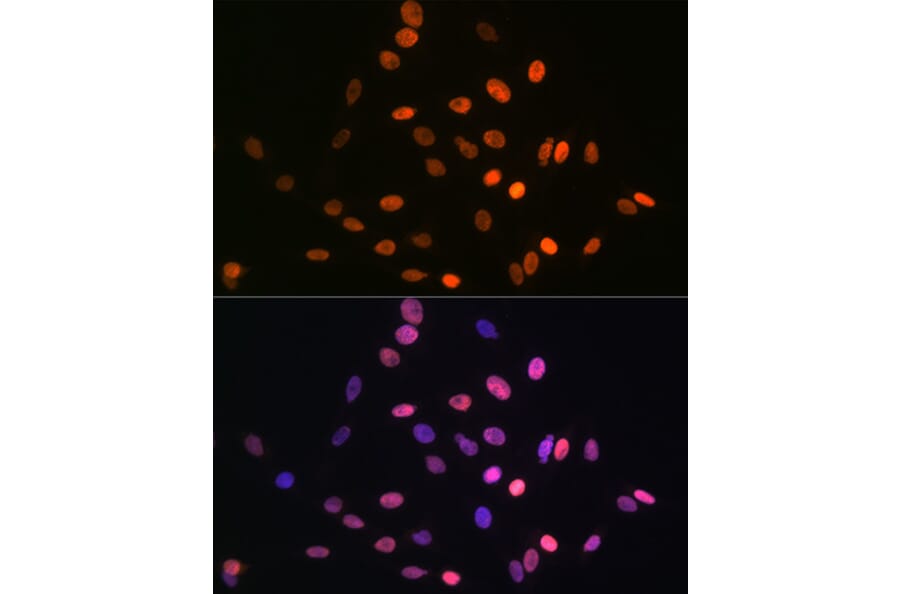 Immunofluorescence - Anti-HMGA1 Antibody [ARC1060] (A307749) - Antibodies.com