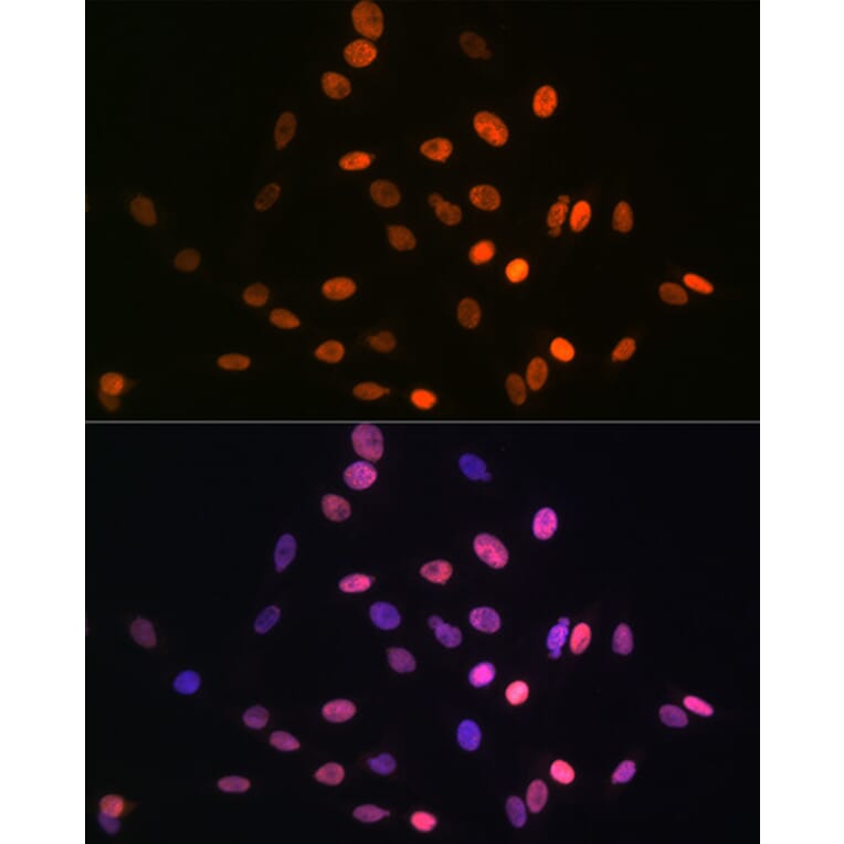 Immunofluorescence - Anti-HMGA1 Antibody [ARC1060] (A307749) - Antibodies.com