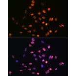 Immunofluorescence - Anti-HMGA1 Antibody [ARC1060] (A307749) - Antibodies.com
