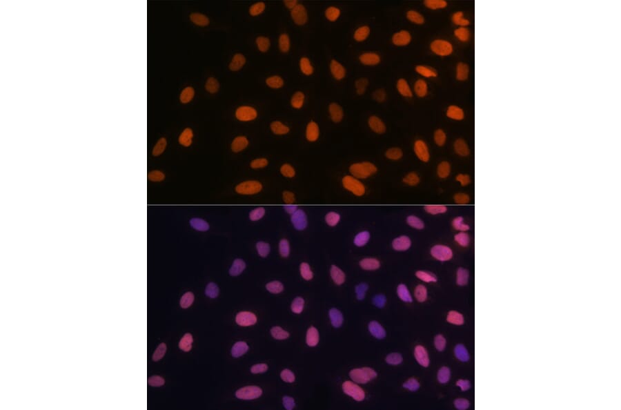 Immunofluorescence - Anti-HMGA1 Antibody [ARC1060] (A307749) - Antibodies.com