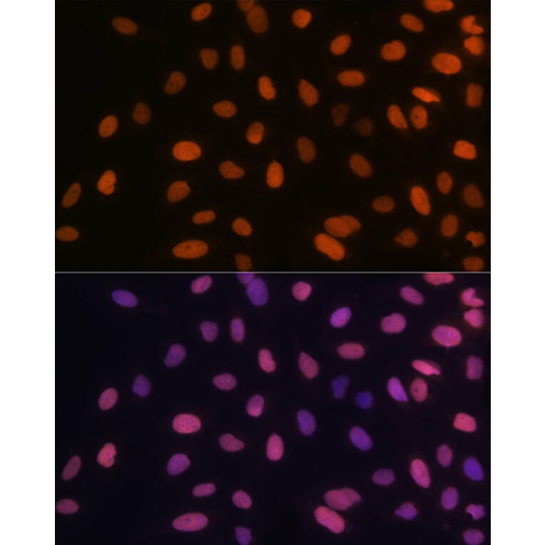 Immunofluorescence - Anti-HMGA1 Antibody [ARC1060] (A307749) - Antibodies.com