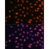Immunofluorescence - Anti-HMGA1 Antibody [ARC1060] (A307749) - Antibodies.com