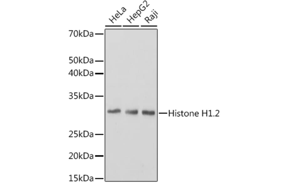 Western Blot - Anti-Histone H1.2 Antibody [ARC1836] (A307750) - Antibodies.com
