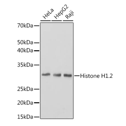 Western Blot - Anti-Histone H1.2 Antibody [ARC1836] (A307750) - Antibodies.com