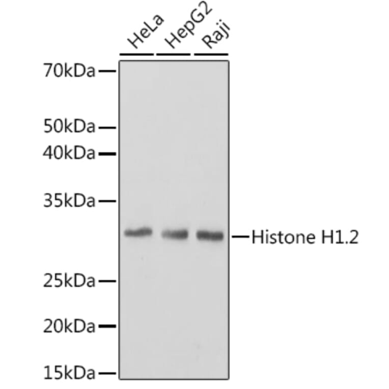Western Blot - Anti-Histone H1.2 Antibody [ARC1836] (A307750) - Antibodies.com