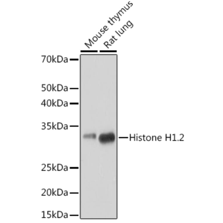 Western Blot - Anti-Histone H1.2 Antibody [ARC1836] (A307750) - Antibodies.com