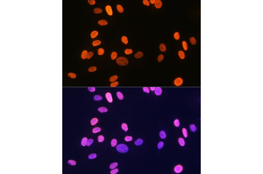 Immunofluorescence - Anti-Histone H1.2 Antibody [ARC1836] (A307750) - Antibodies.com