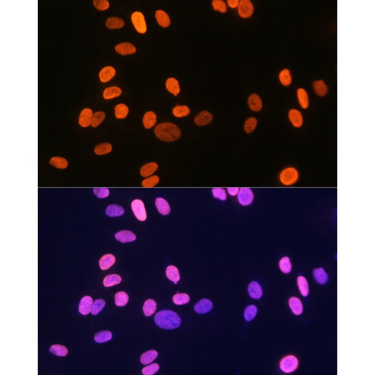 Immunofluorescence - Anti-Histone H1.2 Antibody [ARC1836] (A307750) - Antibodies.com