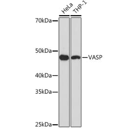 Western Blot - Anti-VASP Antibody [ARC1329] (A307752) - Antibodies.com