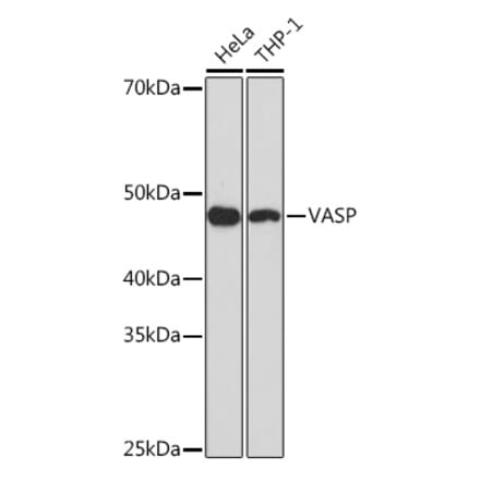 Western Blot - Anti-VASP Antibody [ARC1329] (A307752) - Antibodies.com