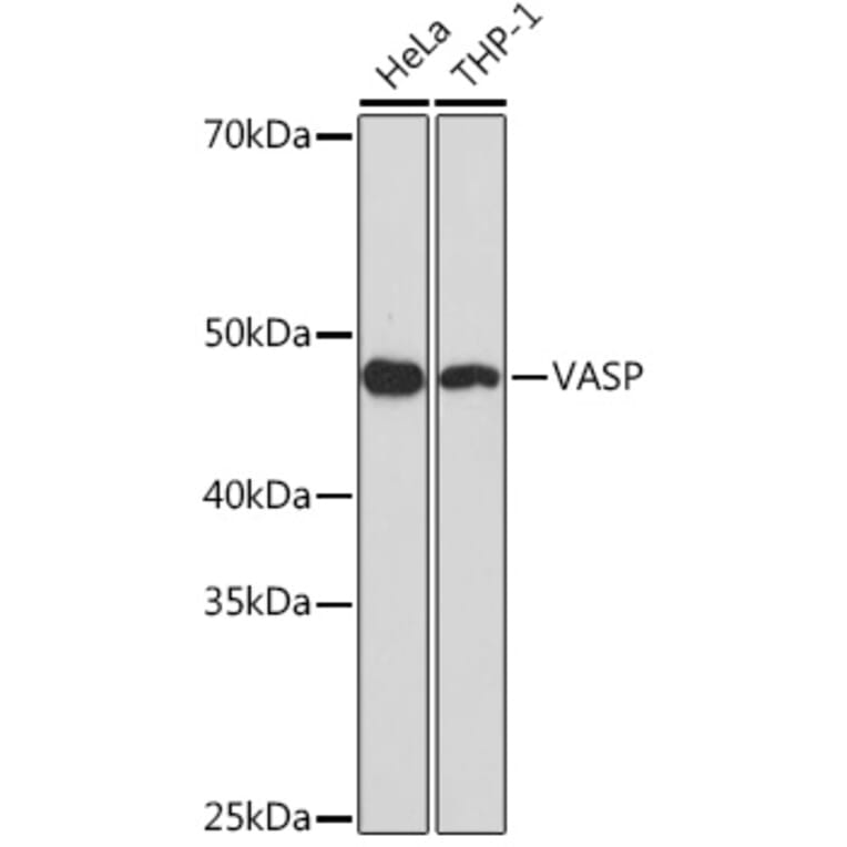 Western Blot - Anti-VASP Antibody [ARC1329] (A307752) - Antibodies.com