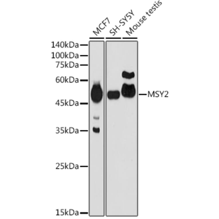 Western Blot - Anti-MSY2/YBOX2/YBX2 Antibody (A307753) - Antibodies.com