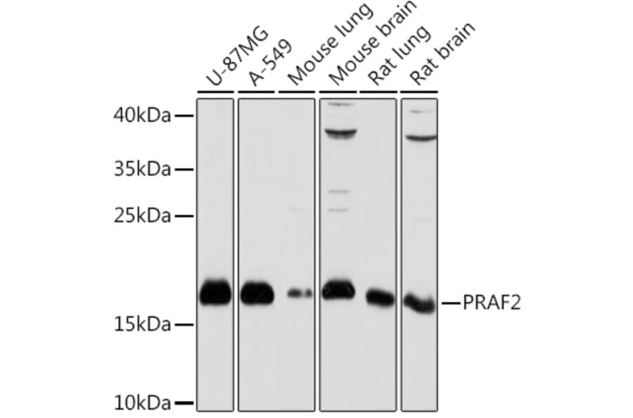 Western Blot - Anti-JM4/PRAF2 Antibody (A307754) - Antibodies.com