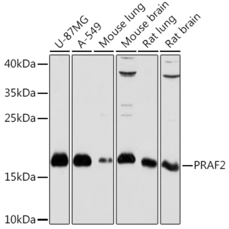 Western Blot - Anti-JM4/PRAF2 Antibody (A307754) - Antibodies.com
