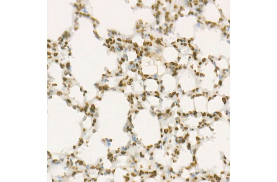Immunohistochemistry - Anti-Wee1 Antibody [ARC57004] (A307755) - Antibodies.com