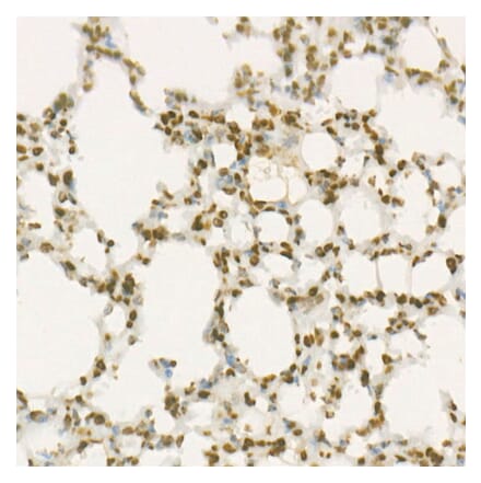 Immunohistochemistry - Anti-Wee1 Antibody [ARC57004] (A307755) - Antibodies.com