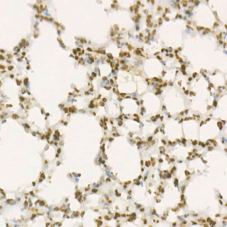 Immunohistochemistry - Anti-Wee1 Antibody [ARC57004] (A307755) - Antibodies.com