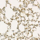 Immunohistochemistry - Anti-Wee1 Antibody [ARC57004] (A307755) - Antibodies.com