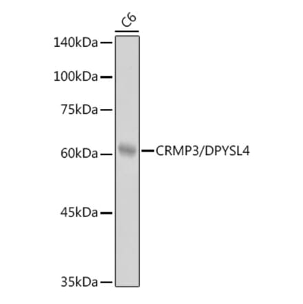 Western Blot - Anti-CRMP3 Antibody [ARC2530] (A307756) - Antibodies.com