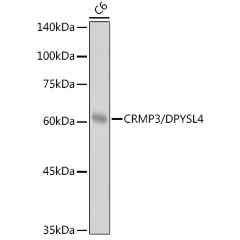 Western Blot - Anti-CRMP3 Antibody [ARC2530] (A307756) - Antibodies.com