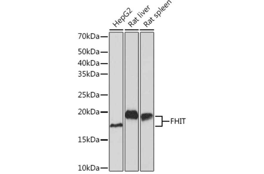 Western Blot - Anti-FHIT Antibody [ARC1401] (A307757) - Antibodies.com