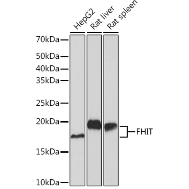 Western Blot - Anti-FHIT Antibody [ARC1401] (A307757) - Antibodies.com