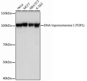 Western Blot - Anti-Topoisomerase I Antibody [ARC0708] (A307759) - Antibodies.com
