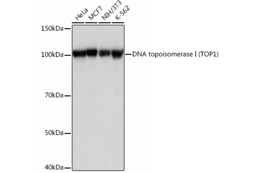 Western Blot - Anti-Topoisomerase I Antibody [ARC0708] (A307759) - Antibodies.com