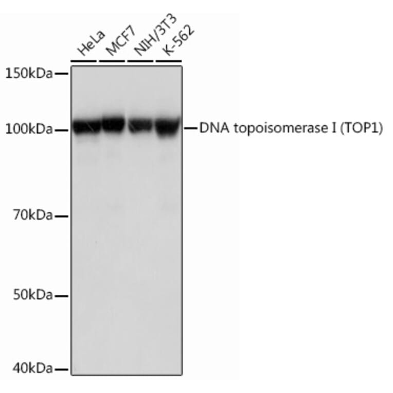 Western Blot - Anti-Topoisomerase I Antibody [ARC0708] (A307759) - Antibodies.com