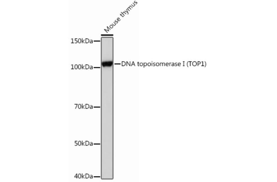 Western Blot - Anti-Topoisomerase I Antibody [ARC0708] (A307759) - Antibodies.com