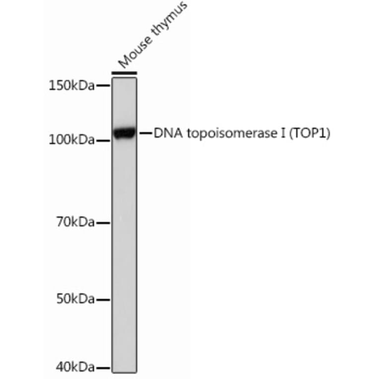 Western Blot - Anti-Topoisomerase I Antibody [ARC0708] (A307759) - Antibodies.com