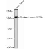 Western Blot - Anti-Topoisomerase I Antibody [ARC0708] (A307759) - Antibodies.com