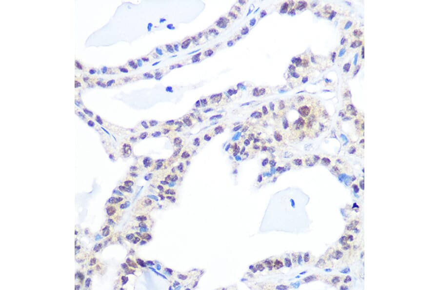Immunohistochemistry - Anti-Topoisomerase I Antibody [ARC0708] (A307759) - Antibodies.com