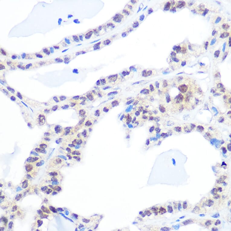 Immunohistochemistry - Anti-Topoisomerase I Antibody [ARC0708] (A307759) - Antibodies.com