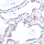 Immunohistochemistry - Anti-Topoisomerase I Antibody [ARC0708] (A307759) - Antibodies.com