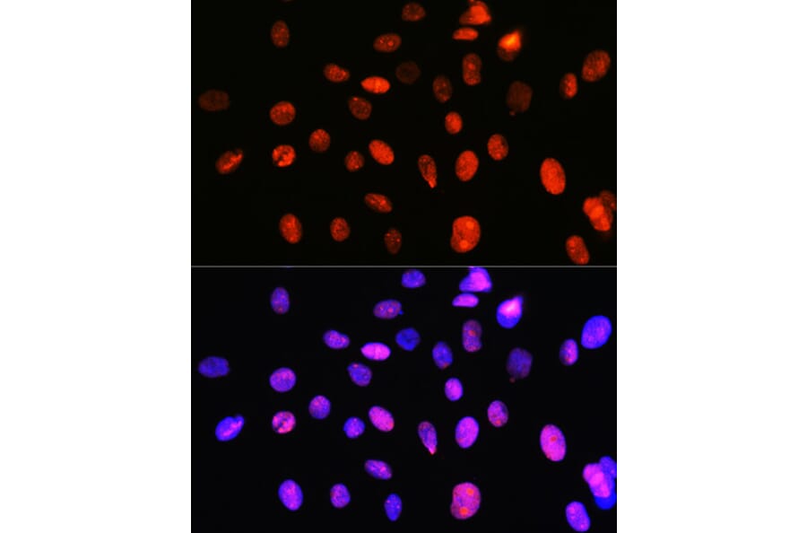Immunofluorescence - Anti-Topoisomerase I Antibody [ARC0708] (A307759) - Antibodies.com