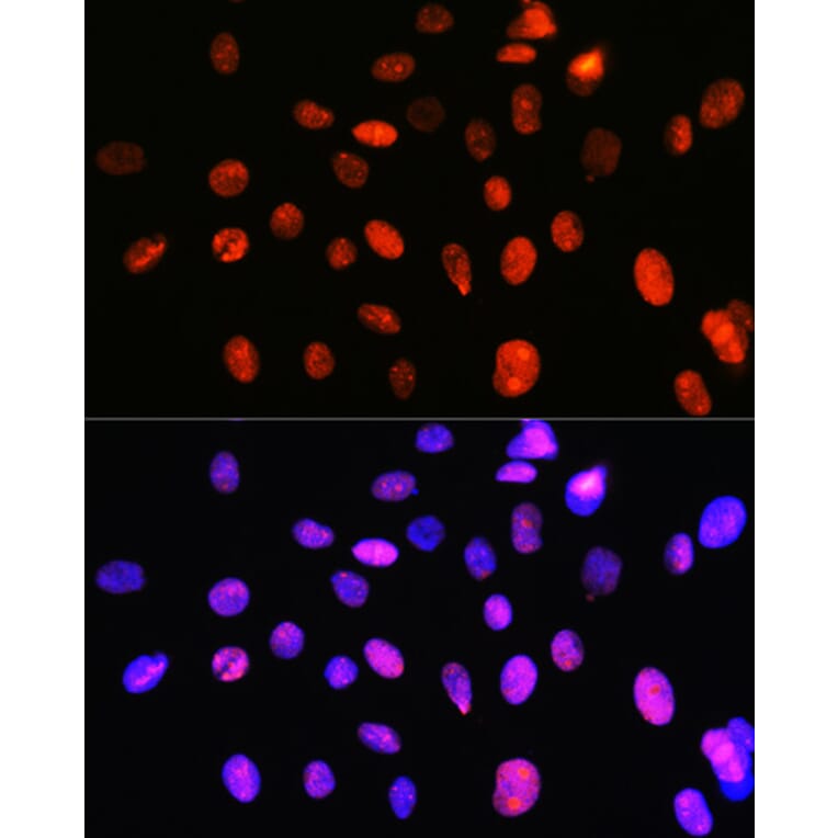 Immunofluorescence - Anti-Topoisomerase I Antibody [ARC0708] (A307759) - Antibodies.com