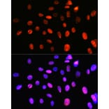Immunofluorescence - Anti-Topoisomerase I Antibody [ARC0708] (A307759) - Antibodies.com