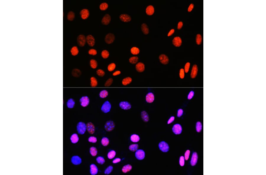 Immunofluorescence - Anti-Topoisomerase I Antibody [ARC0708] (A307759) - Antibodies.com