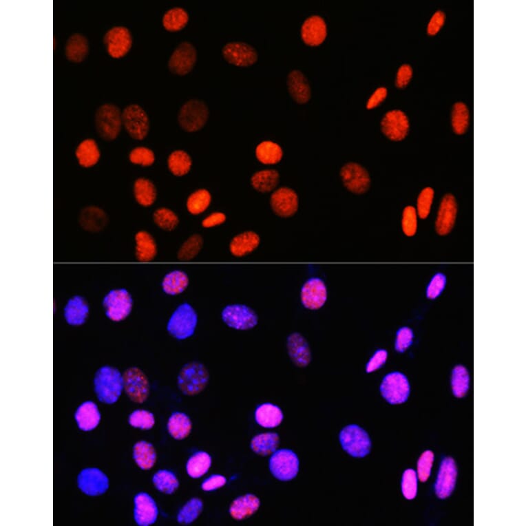 Immunofluorescence - Anti-Topoisomerase I Antibody [ARC0708] (A307759) - Antibodies.com