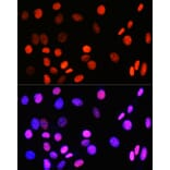 Immunofluorescence - Anti-Topoisomerase I Antibody [ARC0708] (A307759) - Antibodies.com